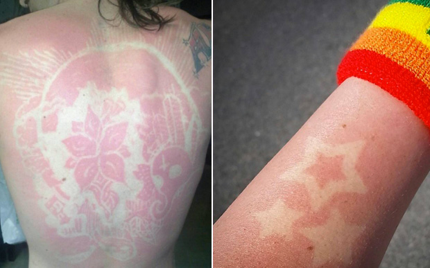 cancer de piele tatuaj