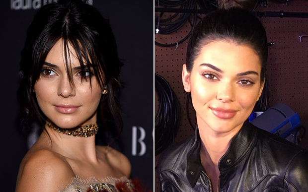 kendall-jenner-preenchimento-labial-1 O que você achou?