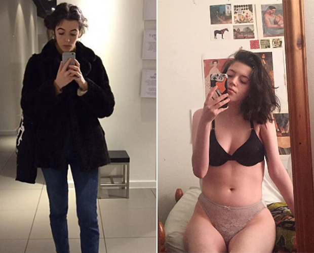 #selflove: Jovem usa Instagram como diário para superar anorexia