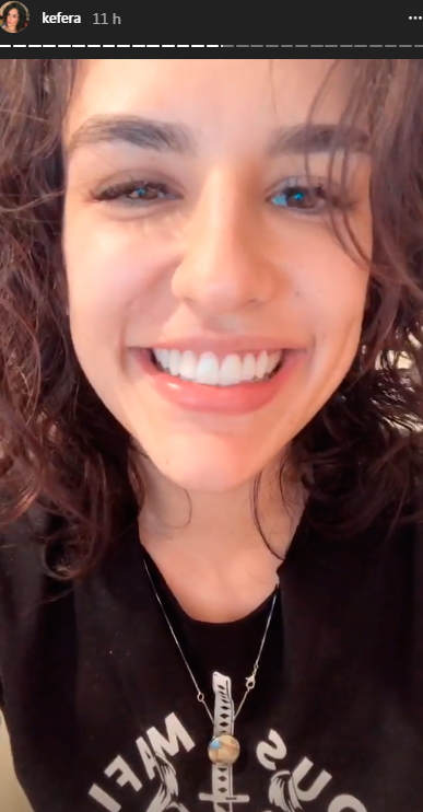 kefera-lente-de-contato-dente-2