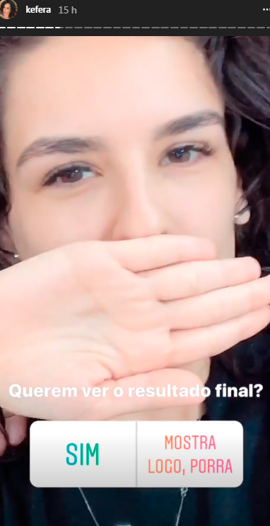 kefera-lente-de-contato-dente