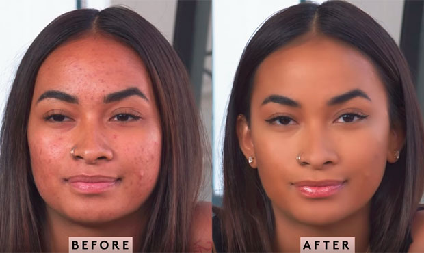 fenty-beauty-tutorial-pele-espinhas-2 fenty-beauty-tutorial-pele-espinhas-2