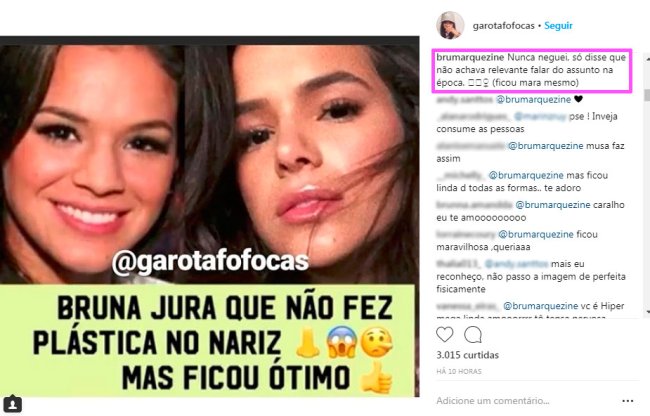 bruna-marquezine-responde-plastica-nariz