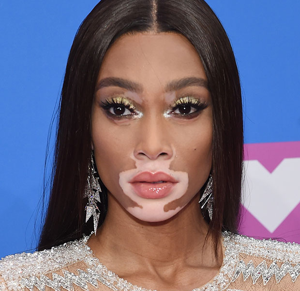 vma-2018-make-cabelo-famosas-Winnie-Harlow vma-2018-make-cabelo-famosas-Winnie-Harlow
