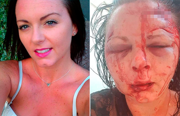 Turista é agredida após dizer para homem que não queria transar com ele