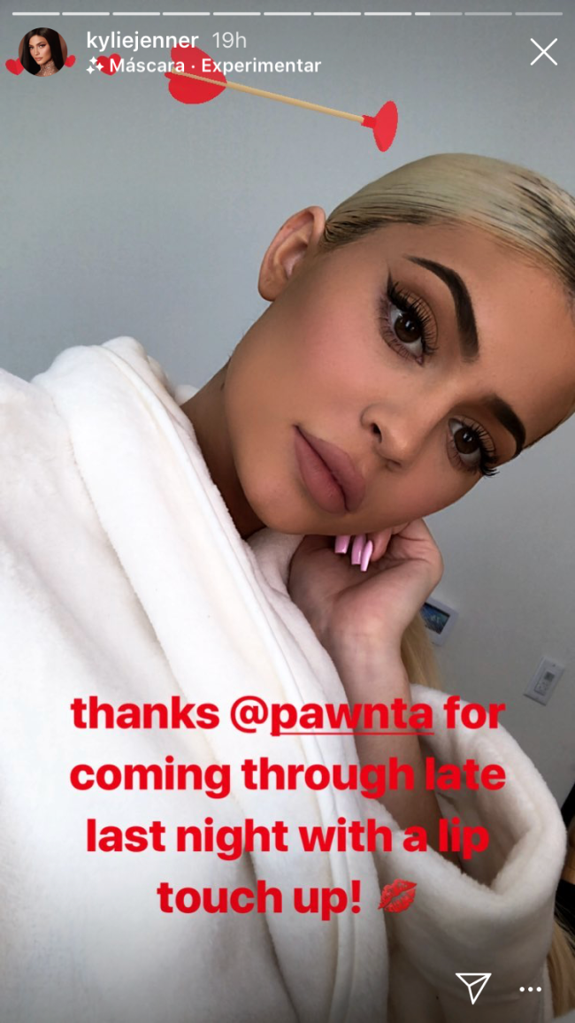 kylie-jenner-preenchimento-labial kylie-jenner-preenchimento-labial
