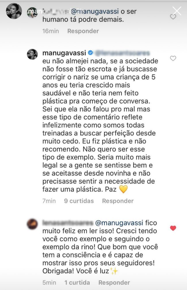 manu-gavassi-resposta-rinoplastia-2 manu-gavassi-resposta-rinoplastia-2