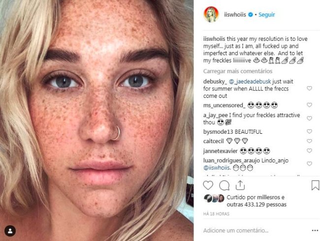 kesha-sem-maquiagem-sardas kesha-sem-maquiagem-sardas
