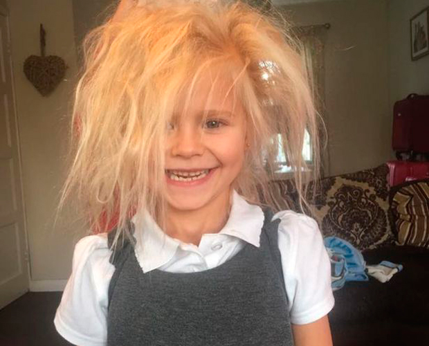 Wynter-Seymour-sindrome-cabelo-impeteavel-2 Wynter-Seymour-sindrome-cabelo-impeteavel-2