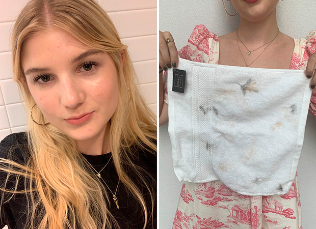 Kylie_Bella-Cacciatore teste musse limpeza kylie jenner