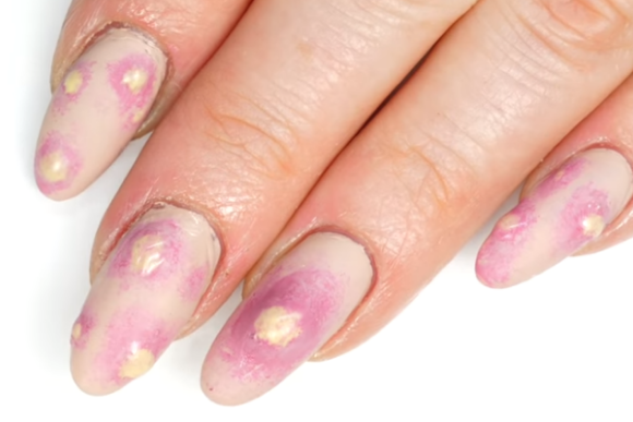 nail-art-de-espinha