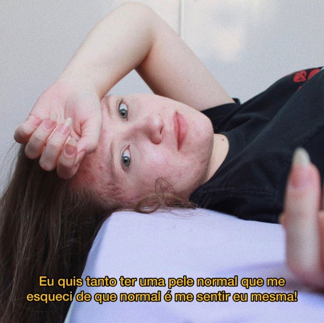 Keren Paiva skin positivity 2