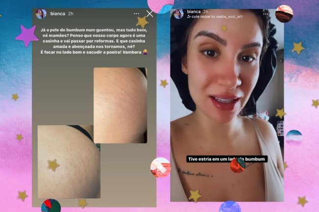 Prints dos stories de Bianca Andrade, no primeiro fotos do bumbum com estrias por conta da gravidez e no segundo Bianca falando com touca no cabelo.