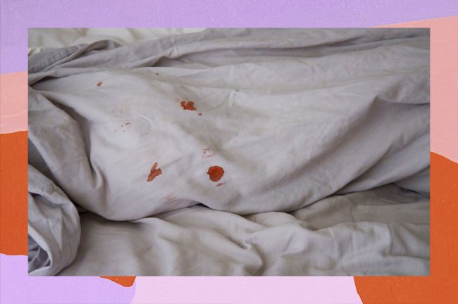 Foto de um lençol branco com pequenas machinhas de sangue menstrual