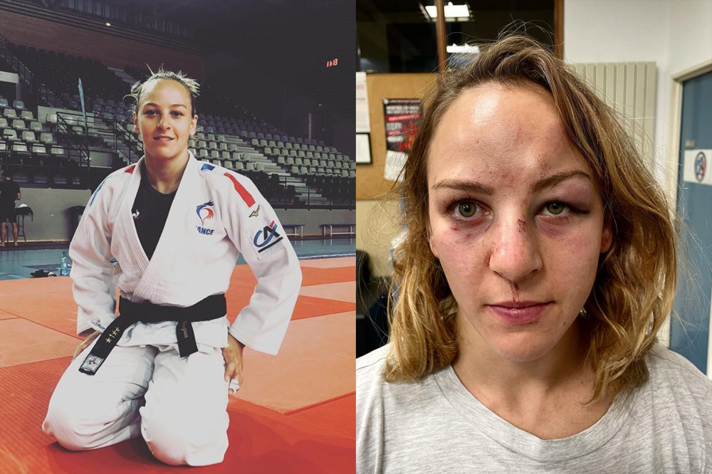 Foto da judoca francesa Margaux Pinot no tatame, em Tóquio 2020. Na imagem ao lado, ela com o rosto completamente desfigurado após sofrer violência doméstica do marido e treinador