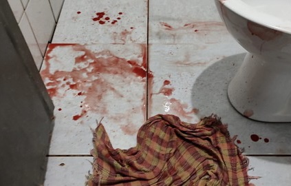 Adolescente é esfaqueada por ex namorado Chão de um banheiro com piso branco, cheio de manchas de sangue
