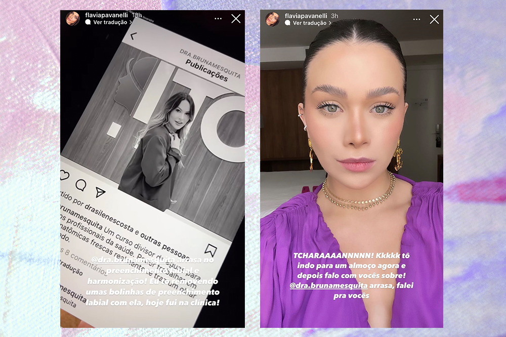 Montagem em fundo lilás com duas capturas de tela do Instagram da Flavia Pavanelli. À esquerda, ela mostra o perfil de sua dentista que removeu seu preenchimento labial, à direita ela mostra o resultado do procedimento em uma selfie.