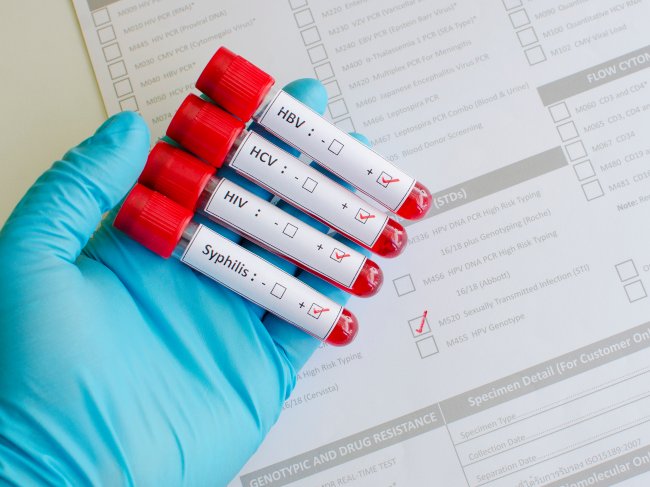 Tubos de ensaio de exames de sangue para infecções sexualmente transmissíveis