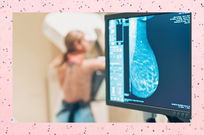 Mulher faz exame de mamografia