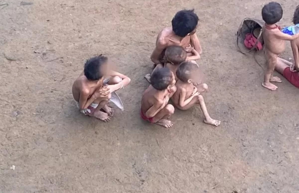 Crianças yanomamis desnutridas