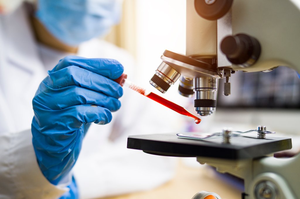 Cientista trabalhando em uma laboratório e manuseando uma amostra de sangue